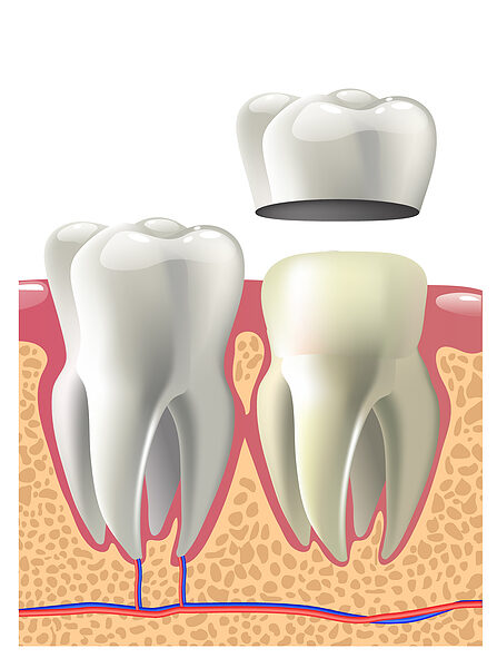Dental Procedure